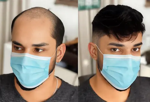 What Is Hair Fixing Service with Smart Hair Fixing