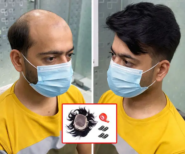 Hair Clipping Service by smart hair fixing in india