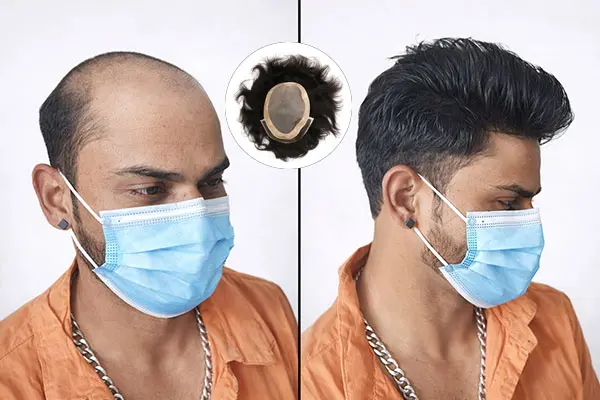 What Is Customized Wigs Service in India