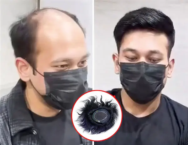 Customized Wigs for Men in India