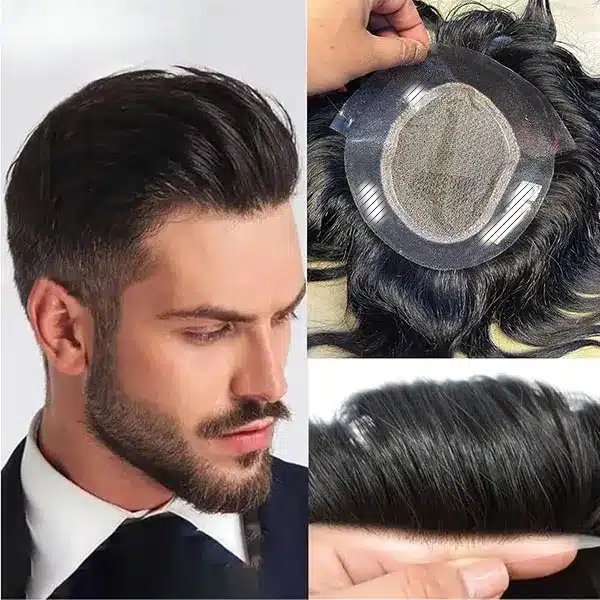 What Is Hair Patch for Men by Smart Hair Fixing